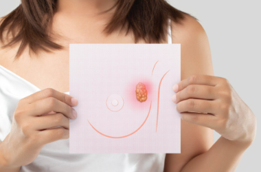 Early Signs of Breast Cancer