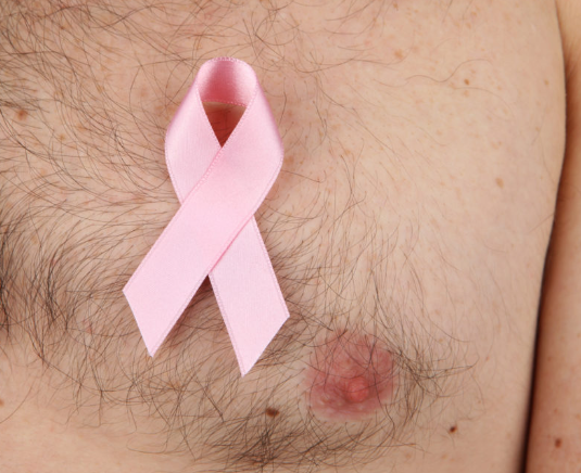 Can Men Get Breast Cancer- Dr Sandeep Nayak