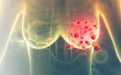 Breast Cancer Screening Guide for Indian Women