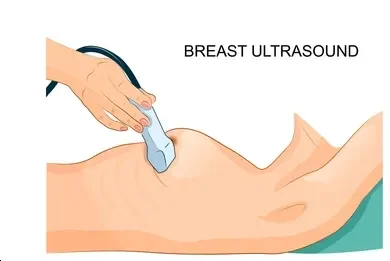 Illustration of a breast undergoing ultrasound with a technician's hand placing a transducer on the breast to image tissue.