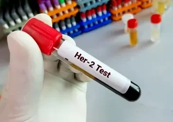 Gloved hand holding a capped test tube labeled 'Her-2 Test' in a busy lab.
